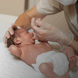 L’intervento Logopedico nel neonato: gestione dell’allattamento e delle disfunzioni orali